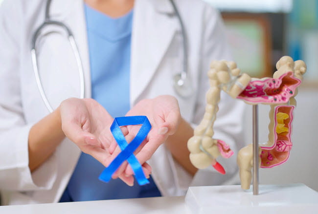 colorectal cancer expert holding a blue ribbon